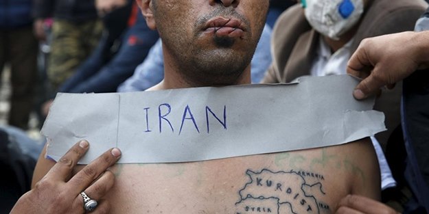 Dudaklarını dikerek protesto ettiler!