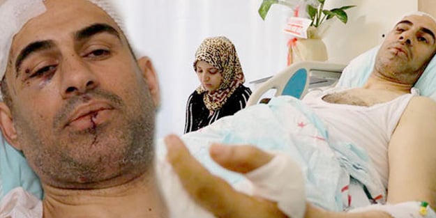Düğüne 2 saat kala feci kaza! Damat tanınmaz hale geldi