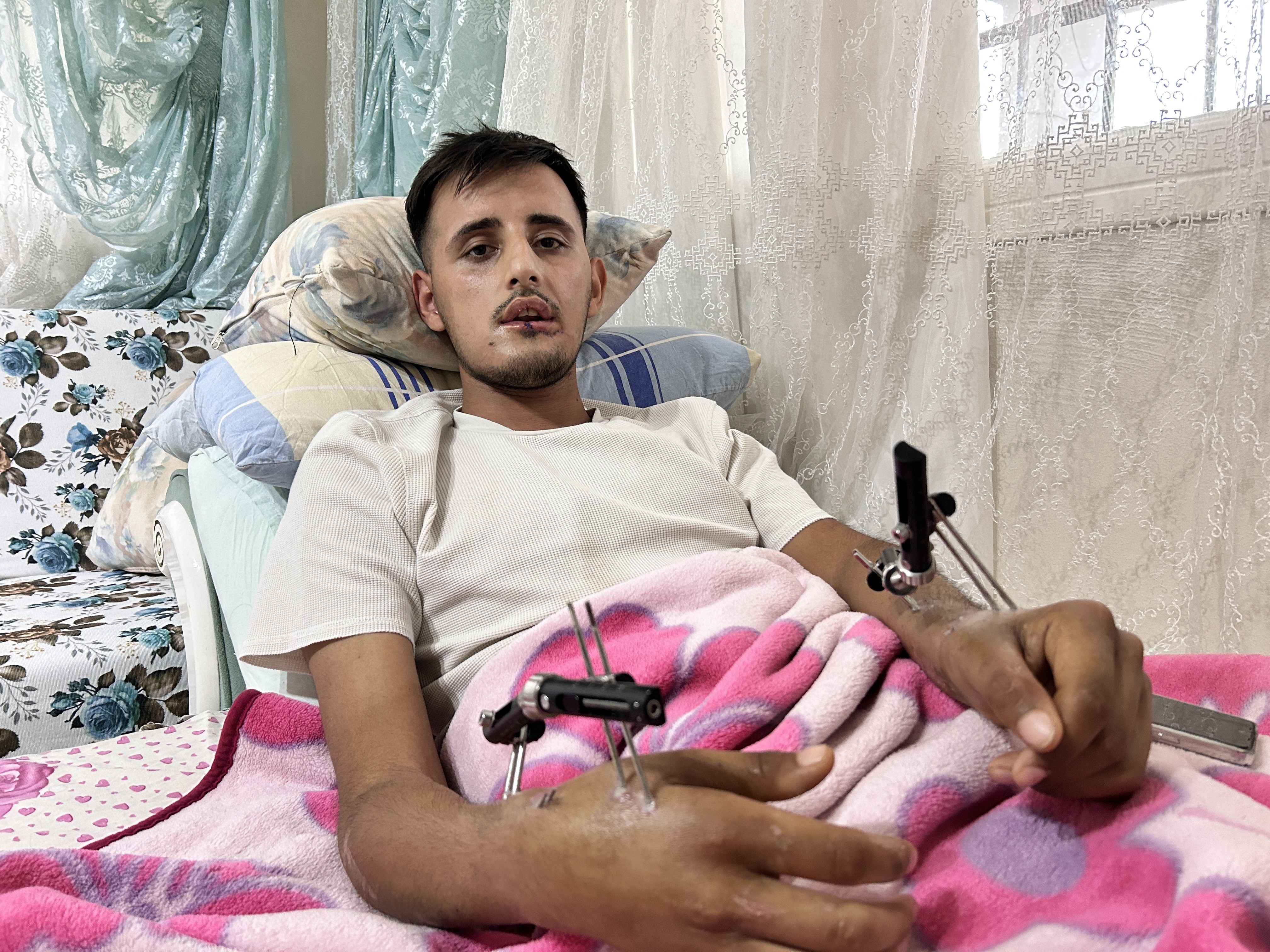 Düğününe bir hafta kala oldu! Tüm hayalleri yıkıldı