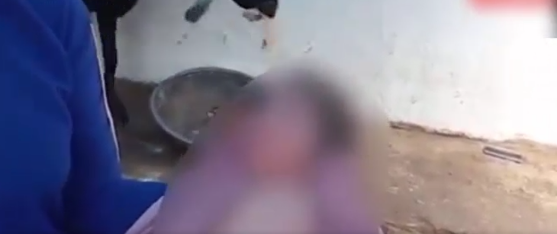 Dünya bu bebeği konuşuyor! 100 binde bir görülüyor