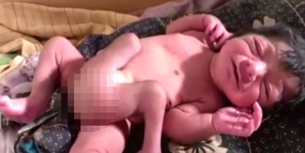 Dünya bu bebeği konuşuyor