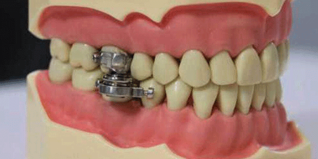 Dünya bu cihazı konuşuyor! Kullananlar hızla kilo veriyor