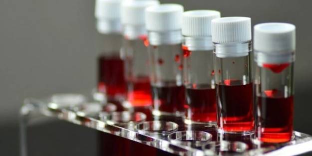 Dünya bunu yeni öğrendi! Bu kan grubuna sahipseniz dikkat