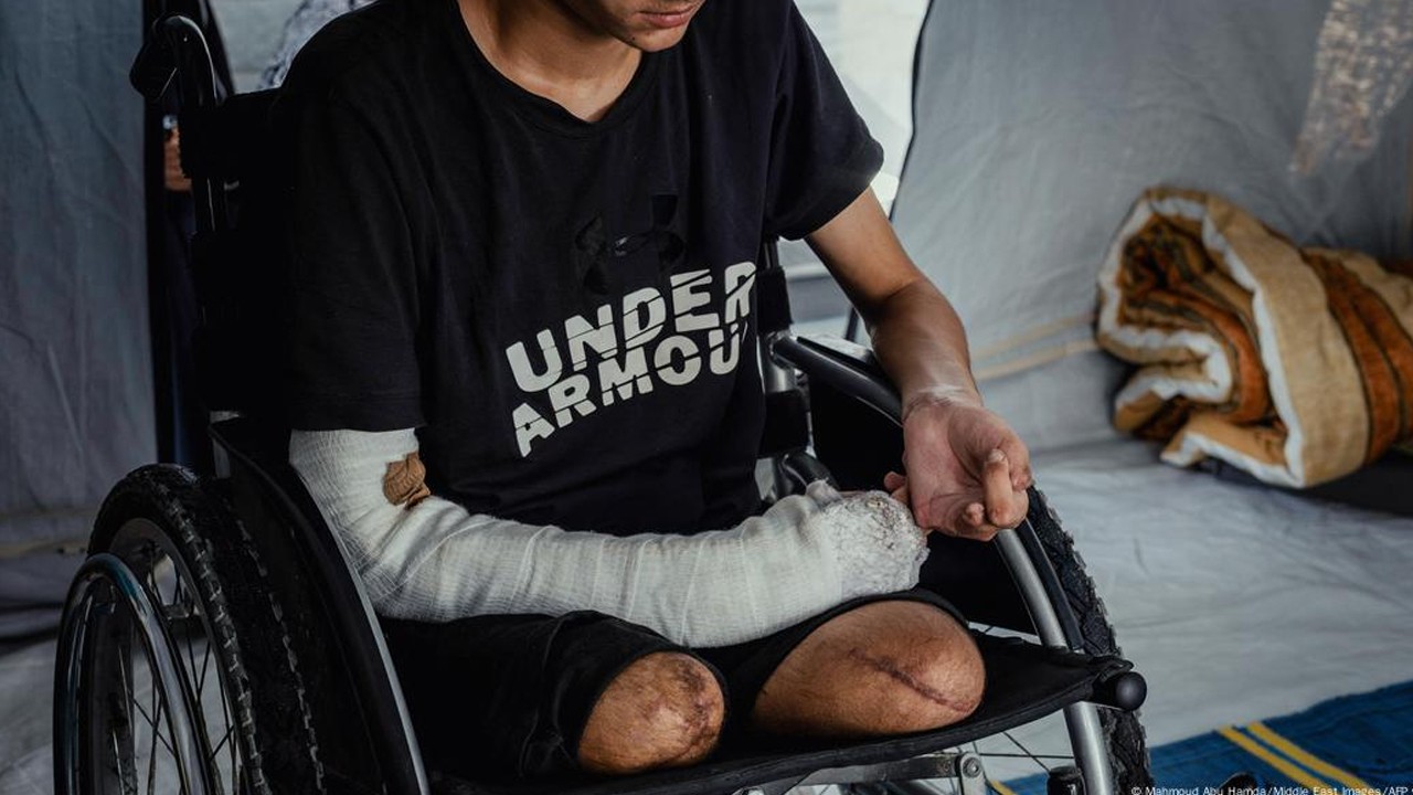 Dünya Sağlık Örgütü: Gazze'de iki yılda 42 bine yakın kişi sakat kaldı