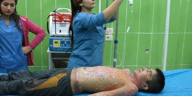 Dünya Sağlık Örgütü'nden kimyasal silah açıklaması!