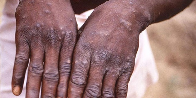 Dünya Sağlık Örgütü'nden 