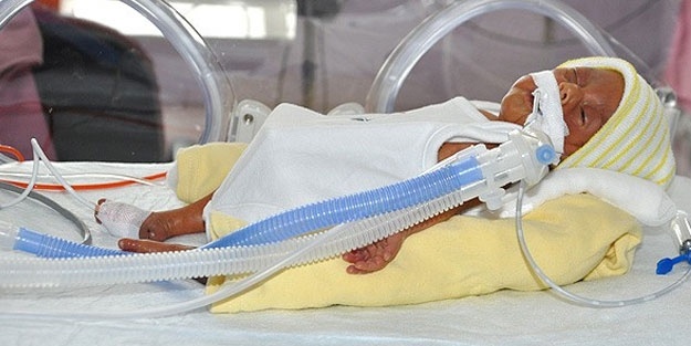 Dünya tıp literatürüne giren bebek doğdu