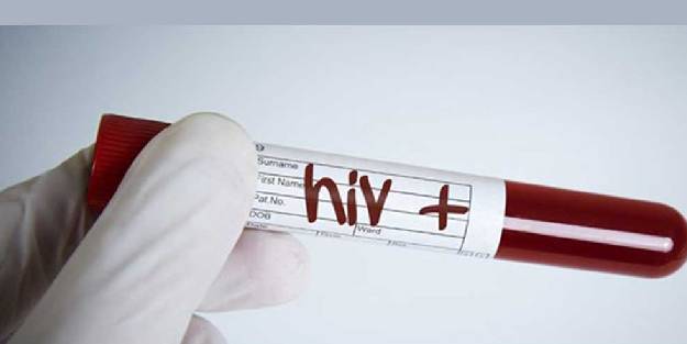  Dünyada 36 milyon insanın hayatını kaybettiği hastalık konusunda uyardı