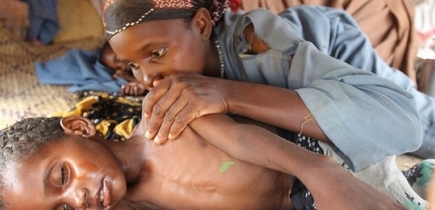 Dünyada Acil Yardıma Muhtaç 25 Milyon İnsan Var