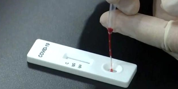 Dünyada bir ilk! 30 dakikada sonuç veren koronavirüs test kitinin evde kullanımına izin verildi