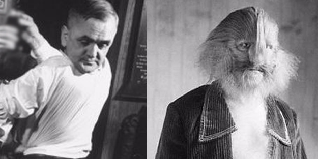 Dünyada eşi benzeri görülmemiş hayret verici hastalıklar!