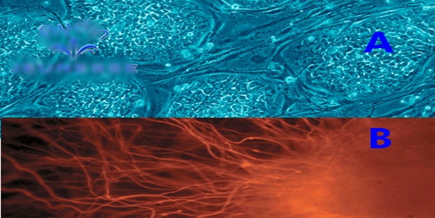 Dünyada ilk kez insandan insana programlanmış kök hücre transferi yapıldı