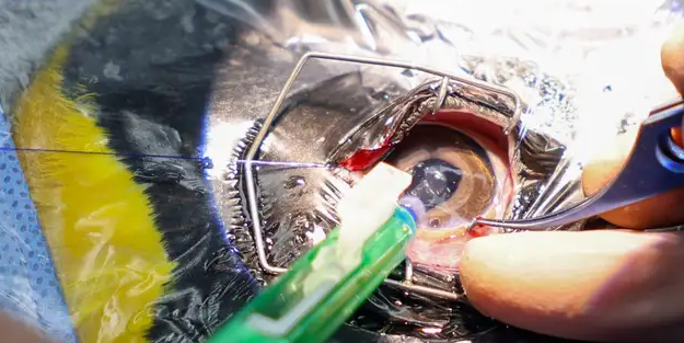 Dünyada ilk kez Singapur’da katarakt ameliyatı! Penguenlere özel üretim lensler takıldı! Akıllı lens...