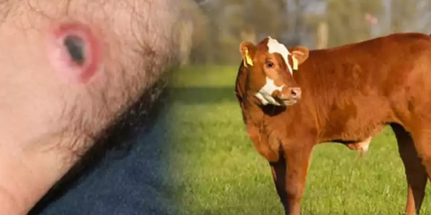 Dünyada yeni şarbon salgını patladı: Uzman sözleri dünyada yankılanıyor! Çoğu insanın bilmediği bilgi