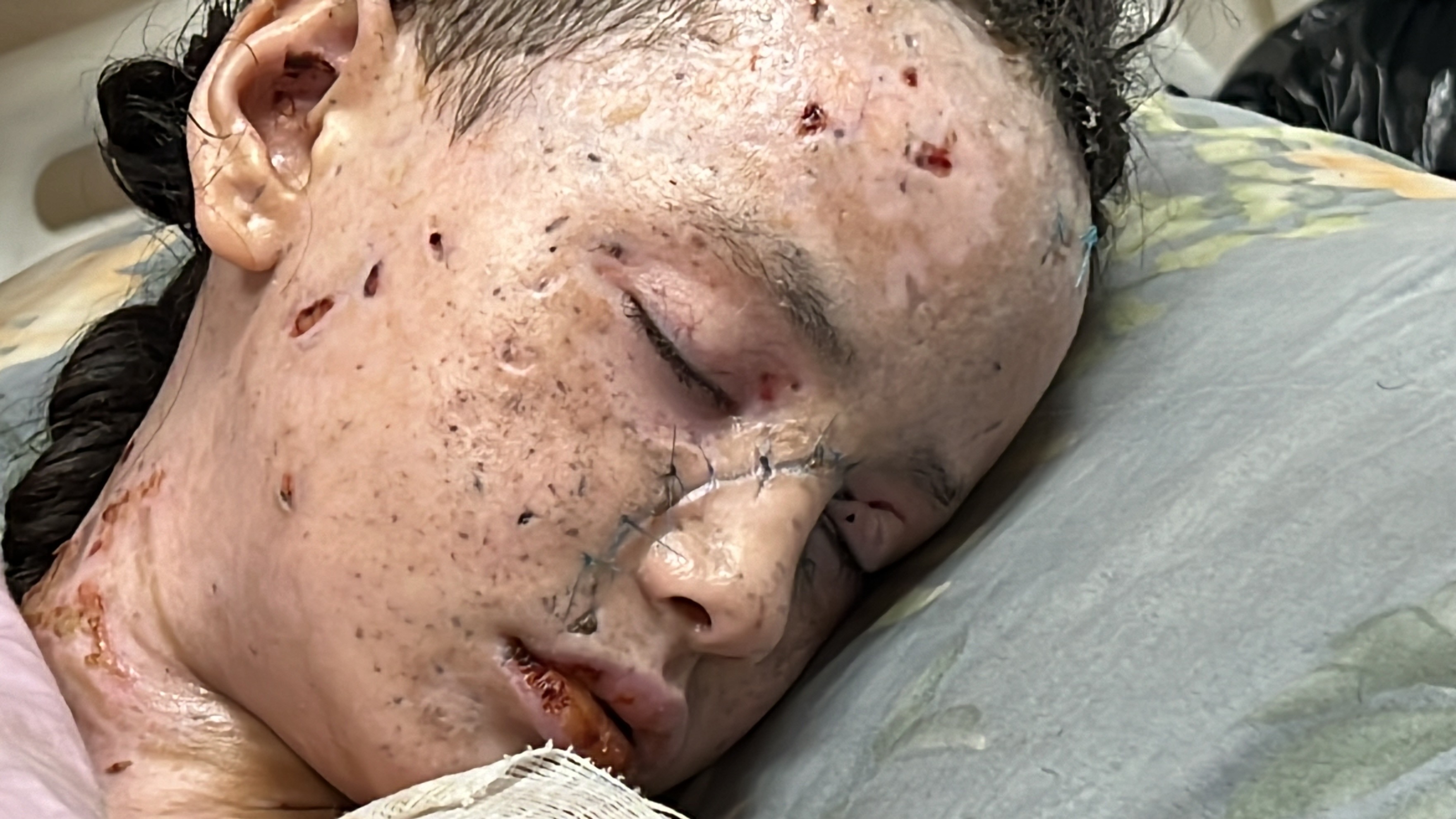 Dünyalar güzeli minik kız bu hale geldi