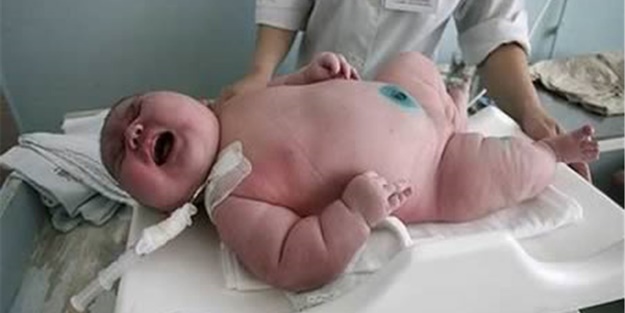 Dünyanın en büyük doğan bebekleri