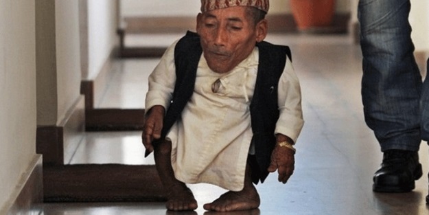 Dünyanın en kısa adamı öldü