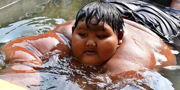 Dünyanın en şişman çocuğu 31 kilo verdi!