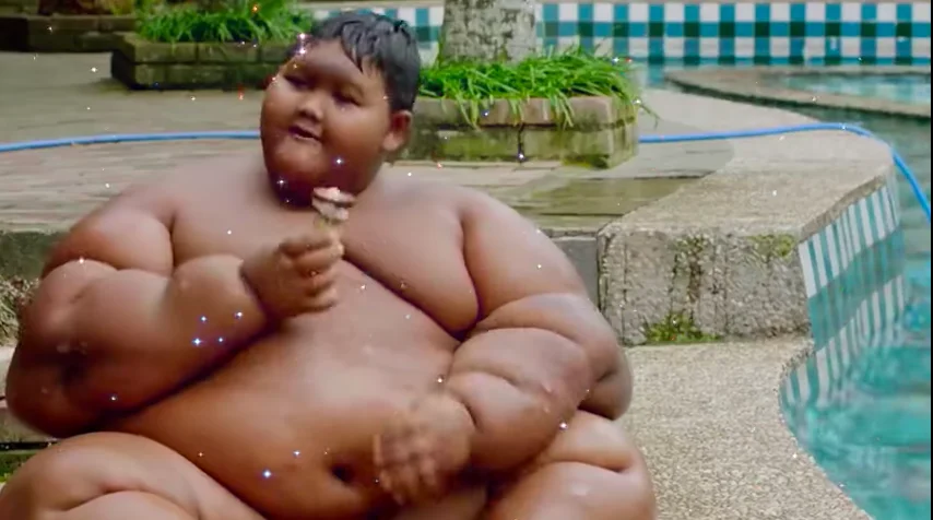 Dünyanın en şişman çocuğunun son hali ağızları bir karış açık bıraktı! Yok artık daha neler canım