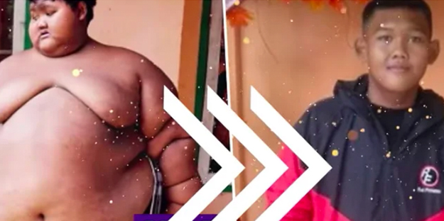 Dünyanın en şişman çocuğunun son haline çok şaşıracaksınız!