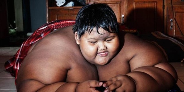 Dünyanın en şişman çocuğuydu! 110 kilo verdi