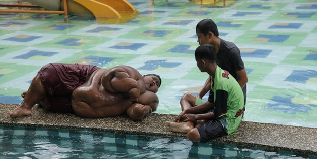 Dünyanın en şişman çocuğuydu! Ameliyat oldu