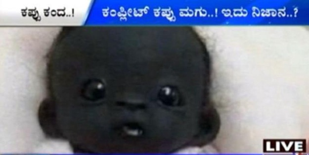 Dünyanın en siyah bebeği sosyal medyayı salladı