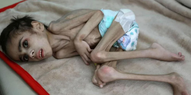 Dünyanın ‘gözüne perde indi’