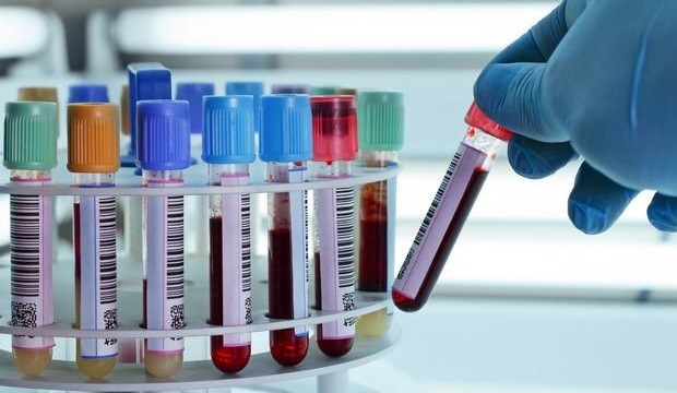 Dünyayı heyecanlandıran haber! Çığır açacak formül