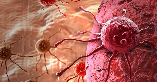 Duruman: Her yıl 400 bin kişi kanser oluyor