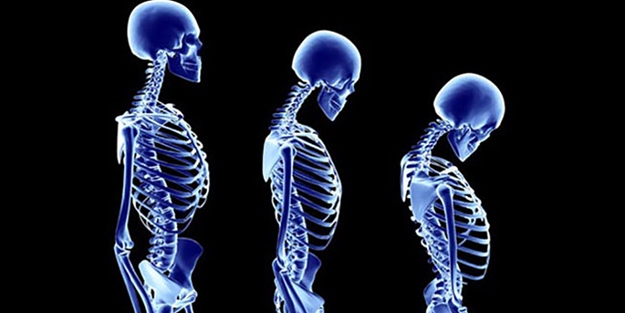 Duruş bozukluğuna liseli mücitlerden müthiş çözüm!