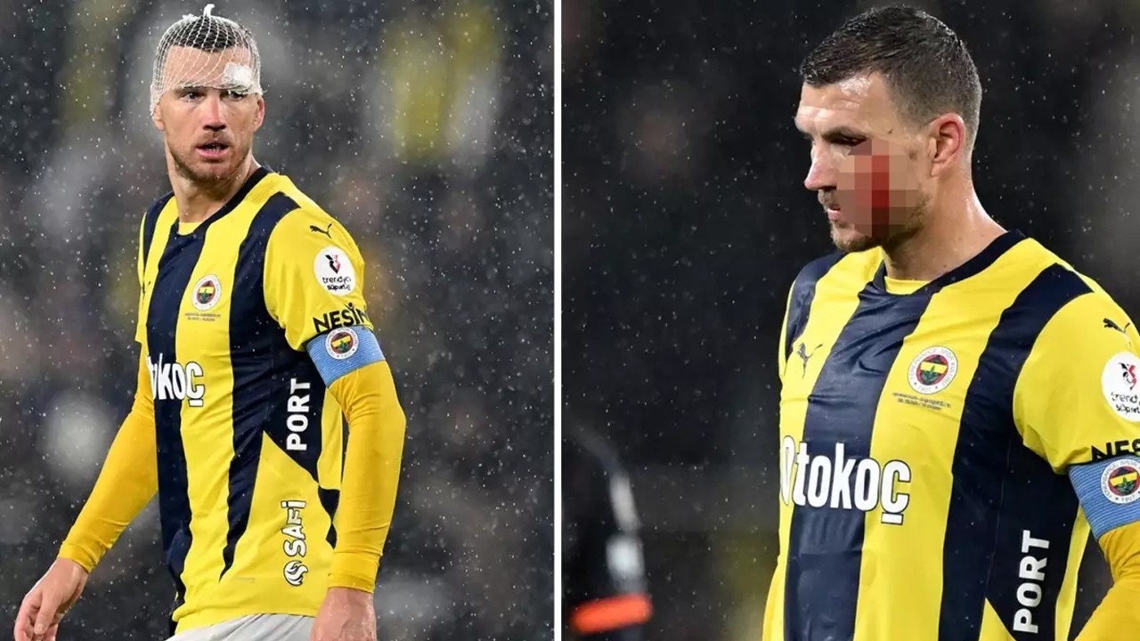 Dzeko’ya kafa atmıştı! Ousseynou Ba sessizliğini bozdu