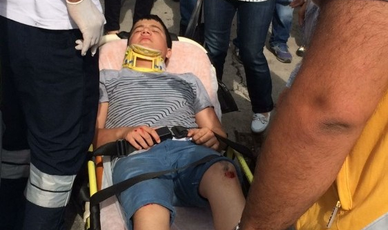 Cip bisiklete çarptı: 1 yaralı