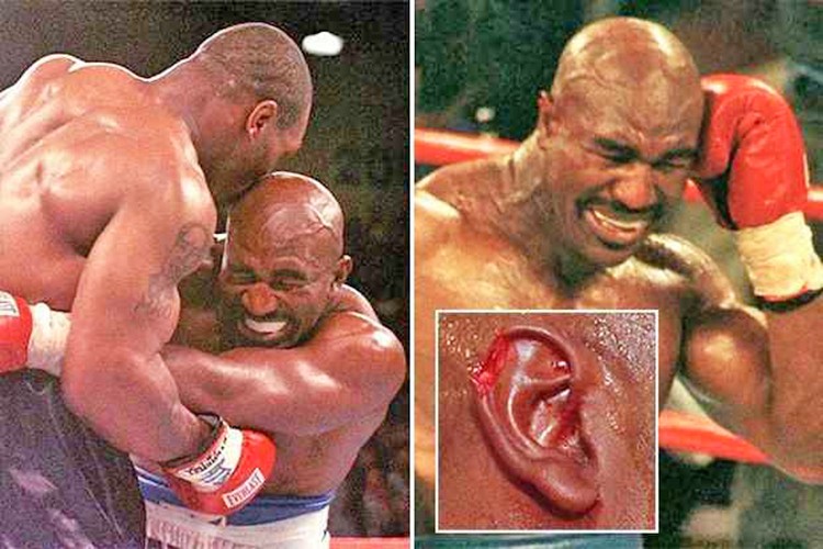 Efsane boksör Mike Tyson’u örnek aldı: Tartıştığı arkadaşının kulağını kopardı