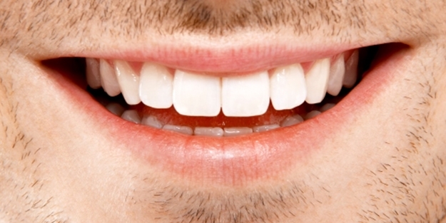 Eğer sizin de dişleriniz böyleyse! Erken yaşta...