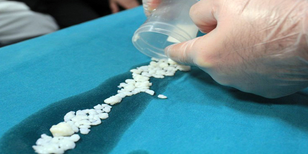 Eklem faresi nedir? Eklem faresi belirtileri nelerdir?