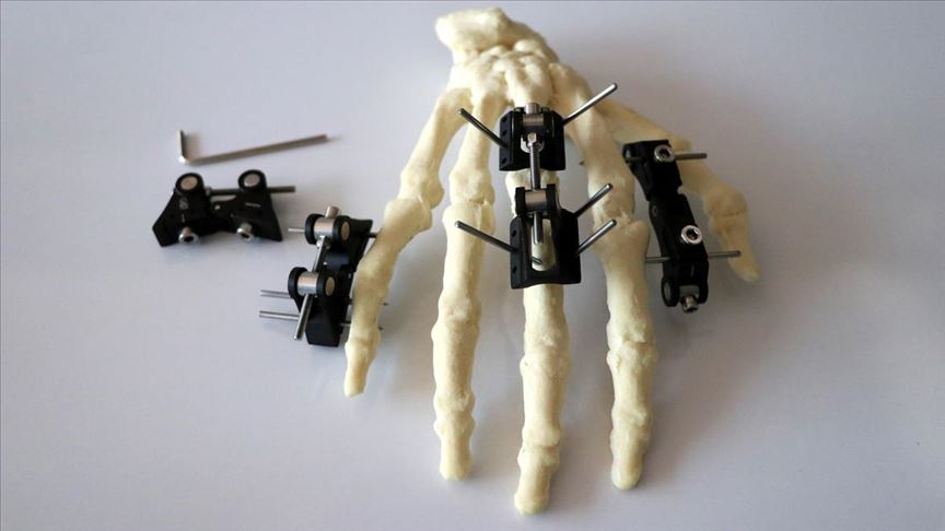 Eklem hareket bozukluklarının tedavisine yerli cihaz