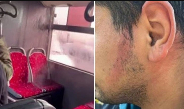 Ekrem'in otobüsünün bir patlamayan kliması vardı! O da patladı!
