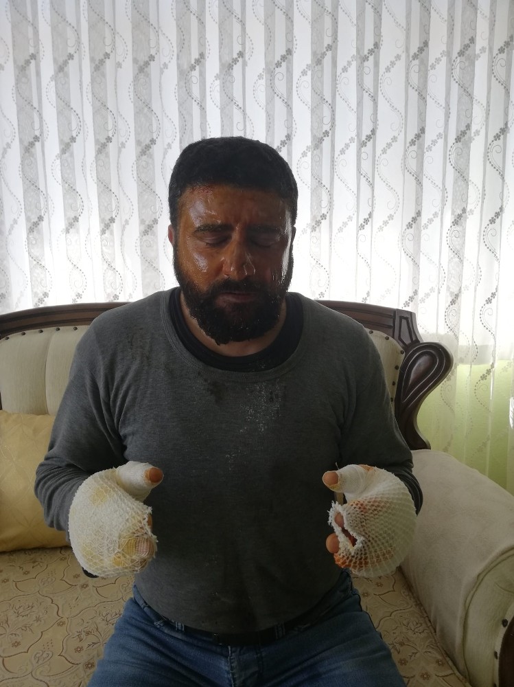 Elektrik çarpması sonucu ağır yaralanan vatandaş taburcu oldu 