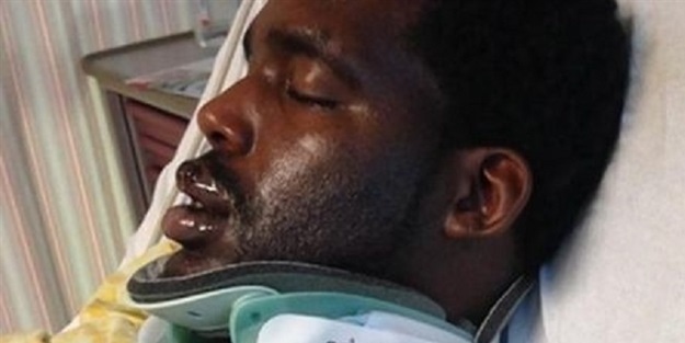 Elektronik sigara ağzında patladı boynu kırıldı