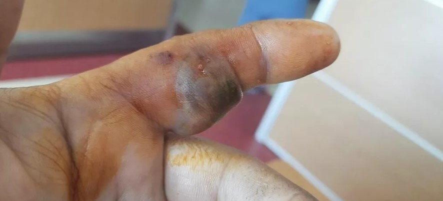 Elinde poşetle hastaneye koştu! Poşetten çıkana kimse inanamadı