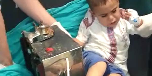 Elini kıyma makinesine sıkıştırdı! Acil ameliyata alındı