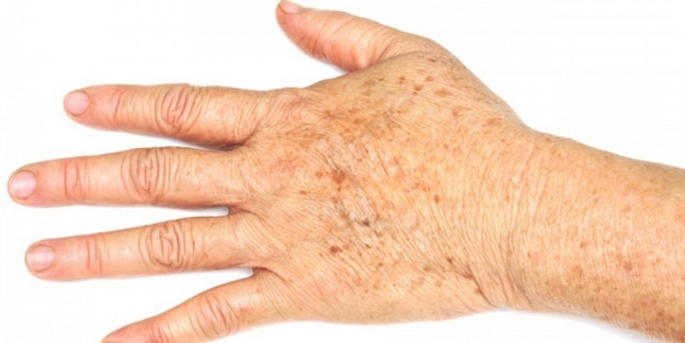 Elinizdeki lekeleri yok edin