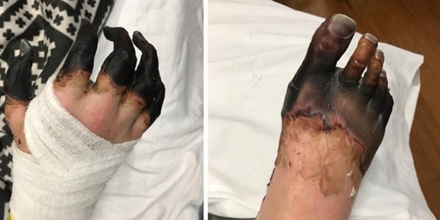 Elleri ve ayakları simsiyah oldu!