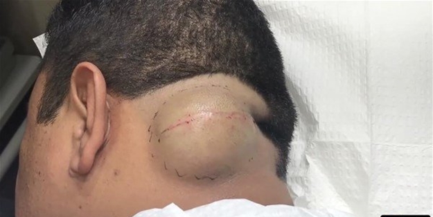 17 yıldır beyninde o hayvanla birlikte yaşamış!