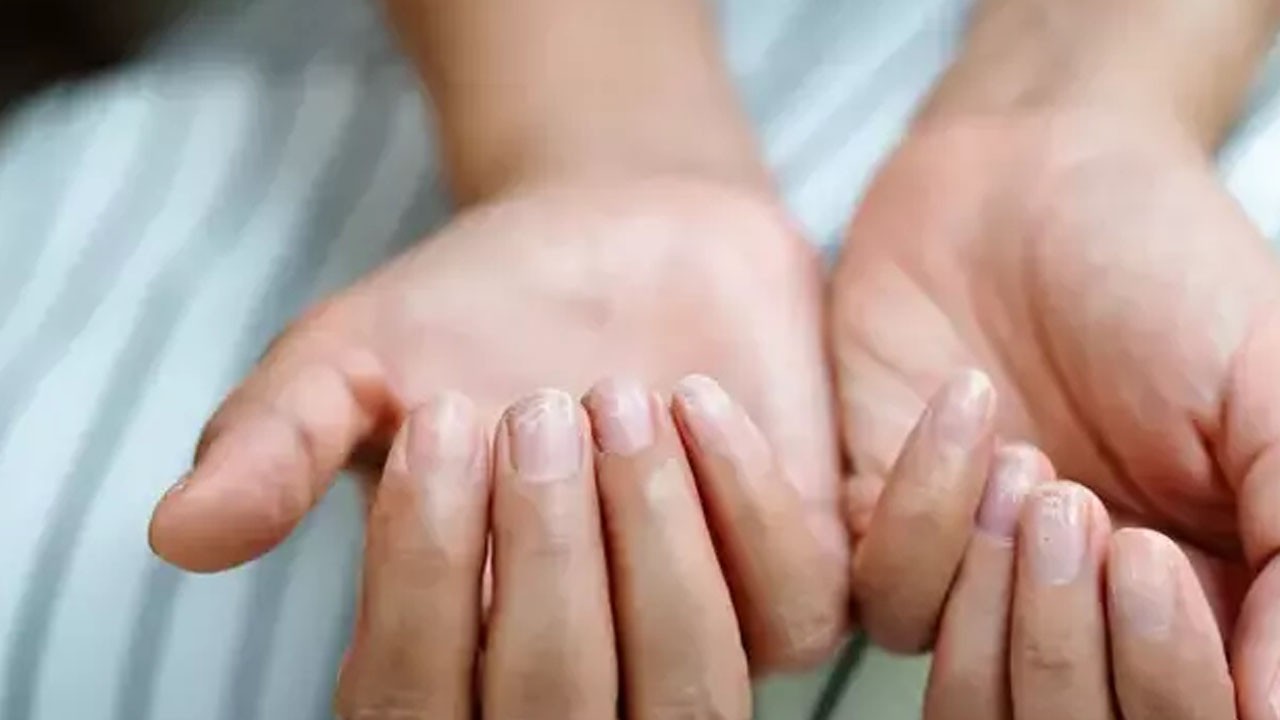 Cilt ve tırnaklara dikkatli bakın! Çok ciddi bir şekilde etkisi olabileceğine yönelik belirtiler