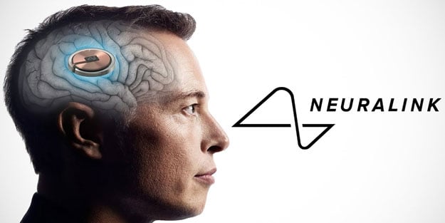 Elon Musk’ın beyin çipi şirketi Neuralink'e para cezası