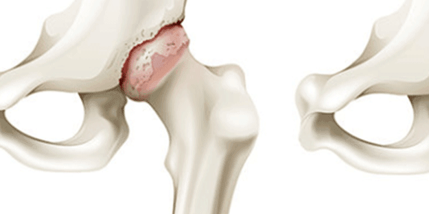 En ilginç 25 bilgi! Kafaları kopsa bile birkaç hafta yaşarlar