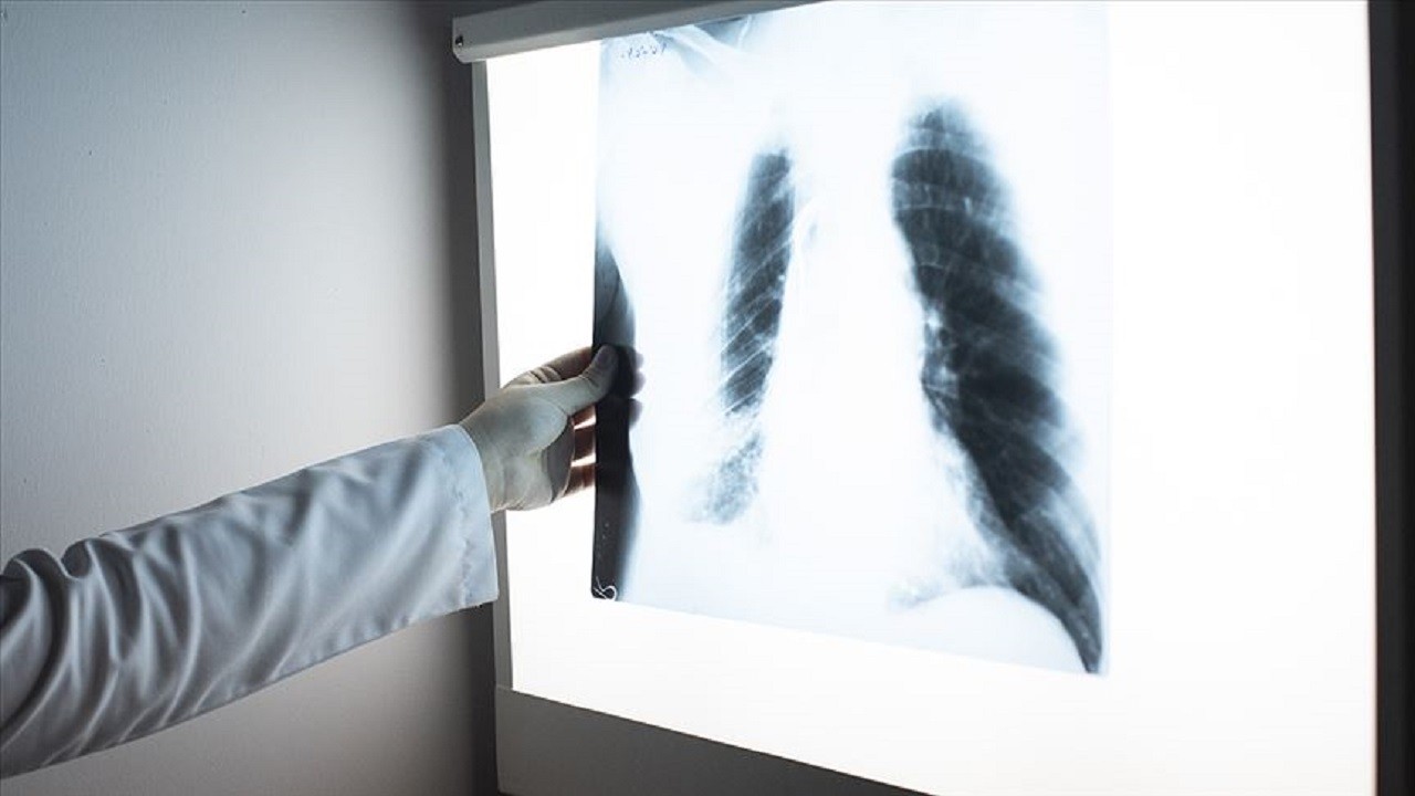 En sık görülen 3. ölüm nedeni! Her 5 kişiden 1’ini etkileyen sessiz tehlike