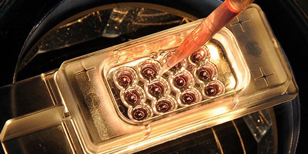 Ender hastalıkların erken teşhisi için yazılım geliştirildi